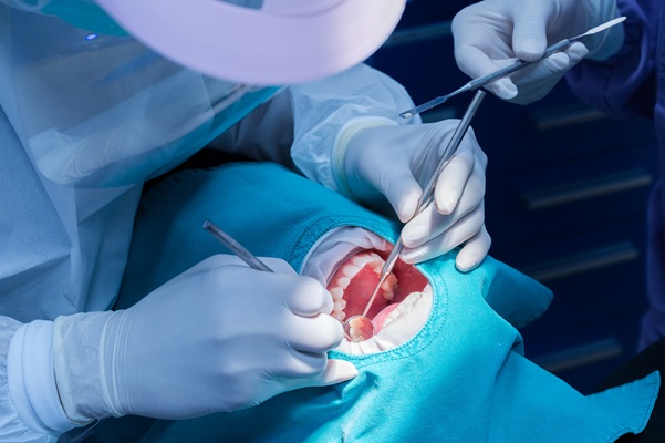 Wisdom Teeth Surgery